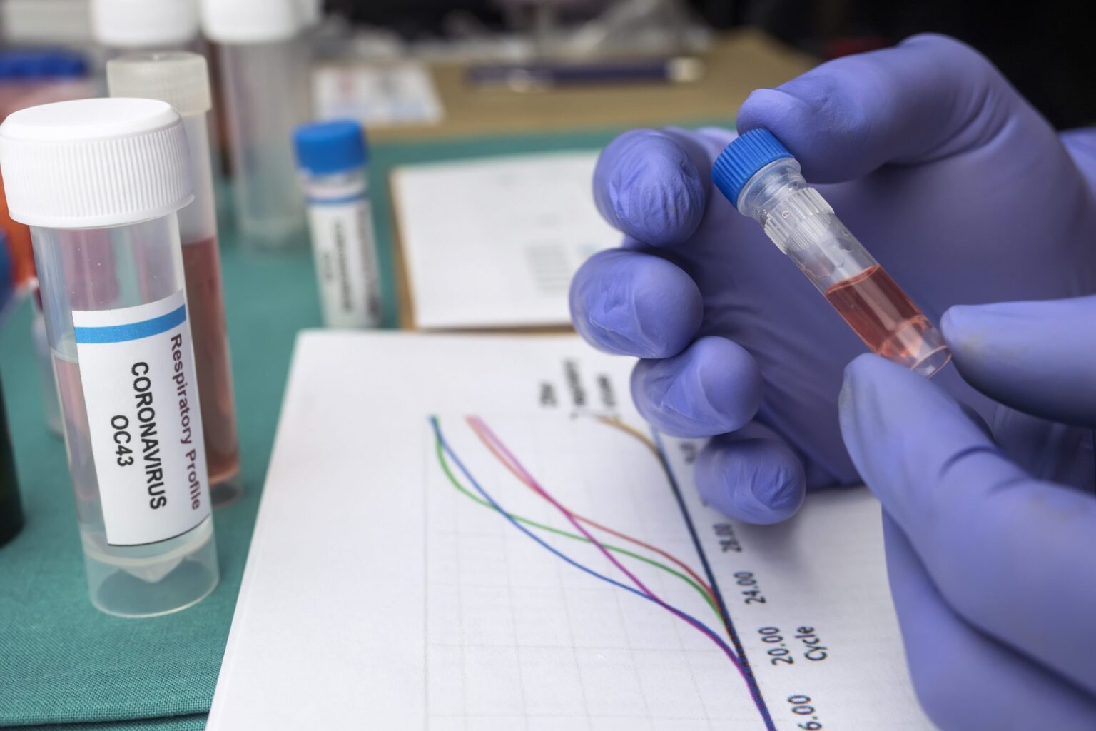 La causa del falso rebrote de coronavirus en la ciudad de Barcelona: un aumento inusual de test serológicos